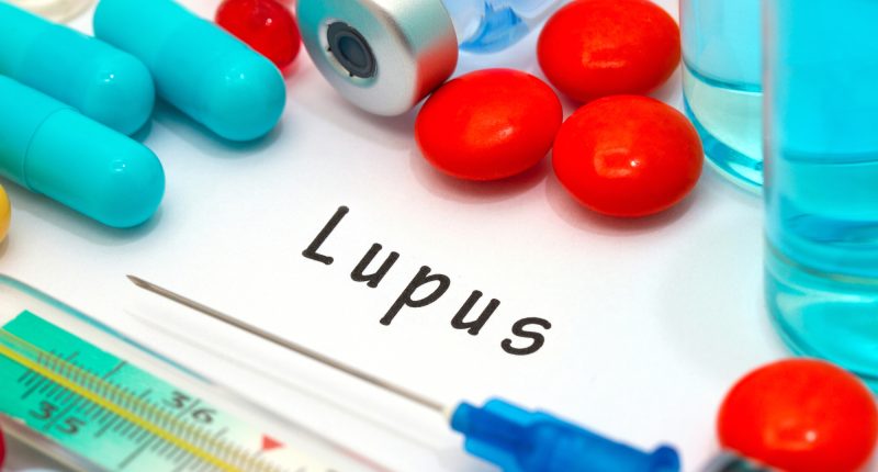 lupus-nebo-li-systemovy-lupus-erythematodes.jpg